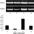 杨梅Cu/Zn超氧化物歧化酶基因（MrSOD1）cDNA的克隆及表达分析