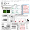 高糖环境下PEDF升高诱导血管内皮细胞凋亡分子机制